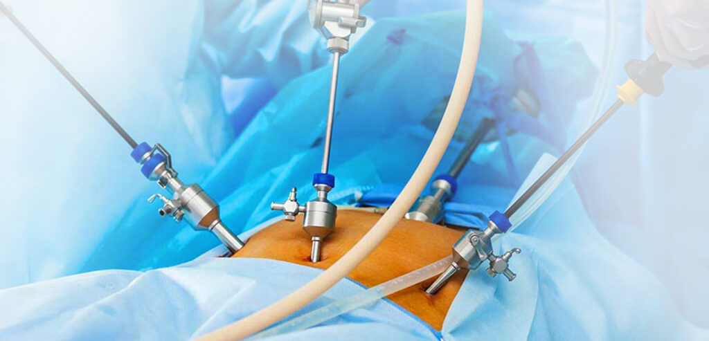 Laparoscopic