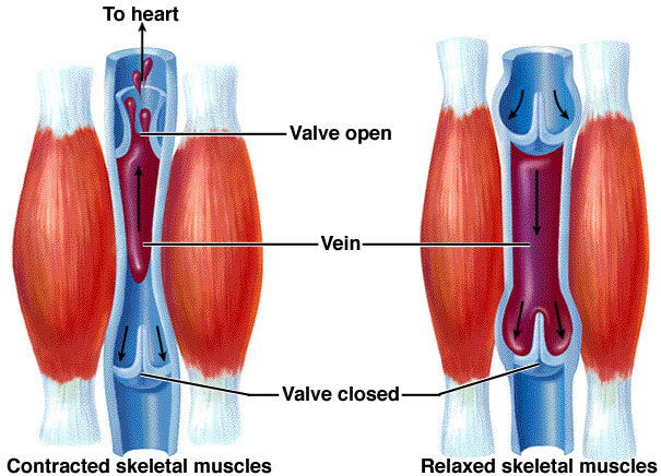 Varicose Veins